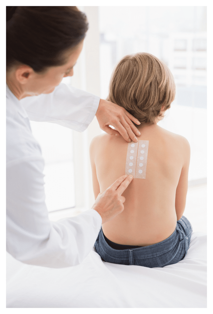 Boy facing away from the camera not wearing a top. He has two strips of allergy patch test containers being stuck to his back by a doctor with surgical tape.