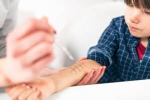 Child undergoing skin prick allergy testing. His sleeve is rolled back and his forearm has a grid drawn on it. And adult is dropping allergy solution into the squares with a pipette. He looks mildly concerned about the process.