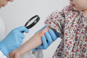 Doctor using magnifying glass to look at patch of angry red eczema on young girls arm at her dermatology appointment